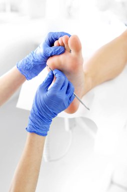 Podiatry. Nasır güzellik uzmanı, bir neşter ile kaldırma.