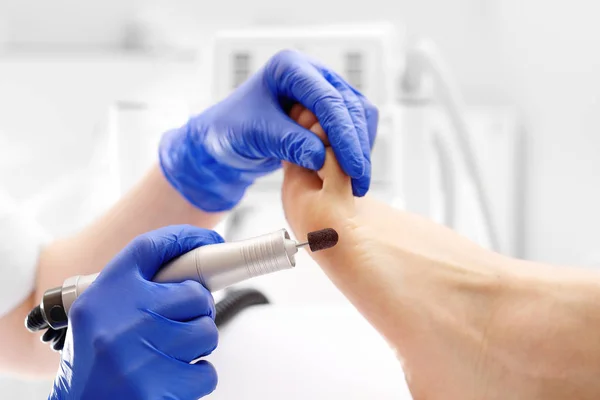 Milling pedicure. The beautician is filing the calluses on the foot — Stock Photo, Image