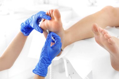 Podiatry. Nasır güzellik uzmanı, bir neşter ile kaldırma.
