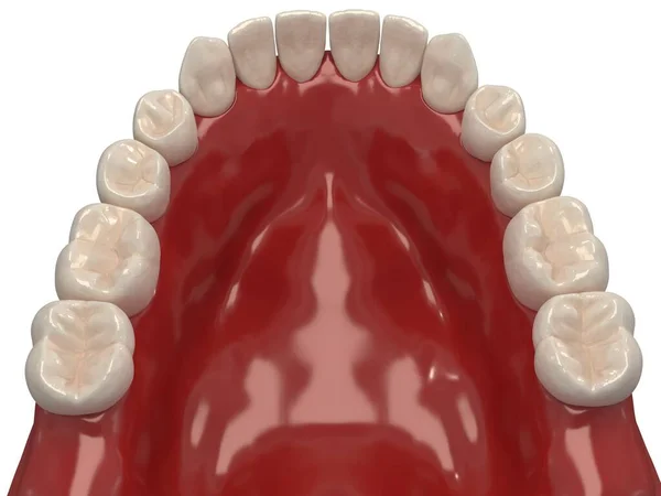Ortodontik cihazlar, ortodontik tedavi sonrası muhafaza için kullanılır. 3d hazırlayıcı