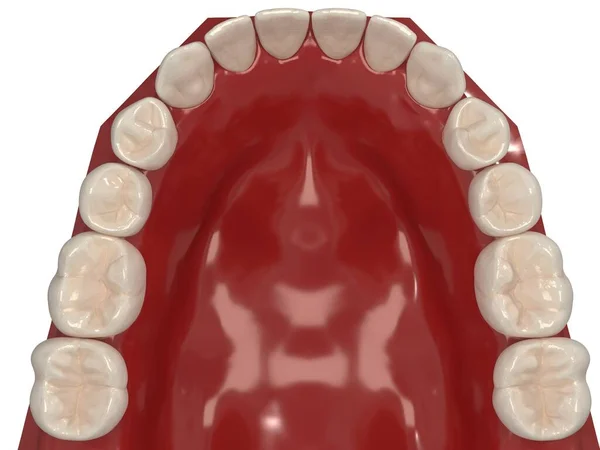 Ortodontik cihazlar, ortodontik tedavi sonrası muhafaza için kullanılır. 3d hazırlayıcı
