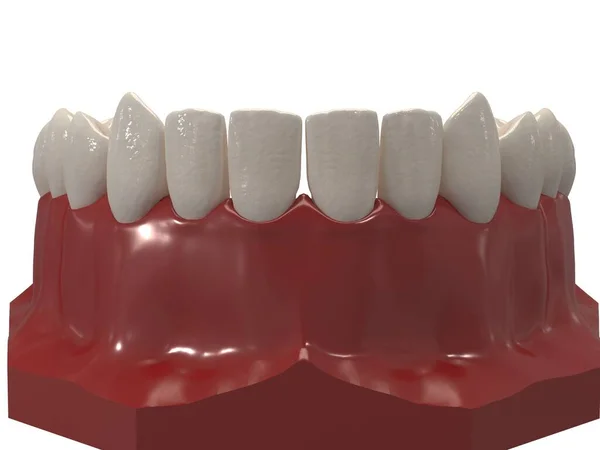 Ortodontik cihazlar, ortodontik tedavi sonrası muhafaza için kullanılır. 3d hazırlayıcı