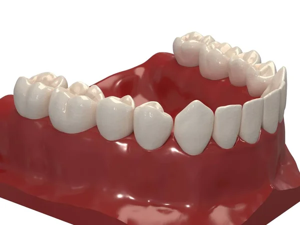 Ortodontik cihazlar, ortodontik tedavi sonrası muhafaza için kullanılır. 3d hazırlayıcı