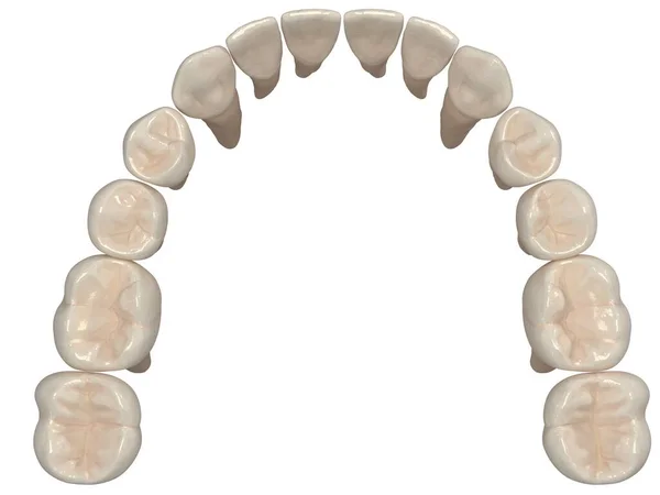 Ortodontik Cihazlar Ortodontik Tedavi Sonrası Muhafaza Için Kullanılır Hazırlayıcı — Stok fotoğraf