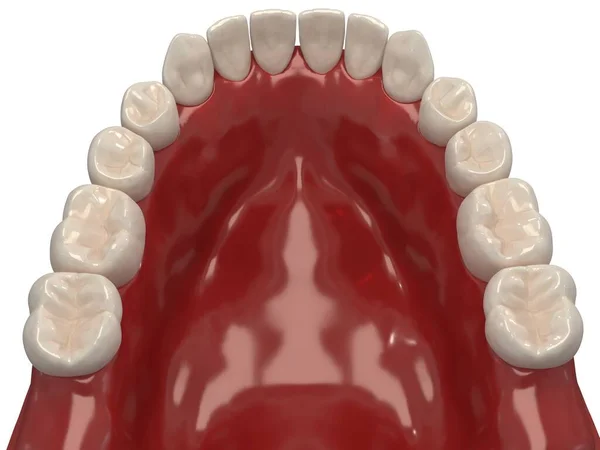 Ortodontik cihazlar, ortodontik tedavi sonrası muhafaza için kullanılır. 3d hazırlayıcı