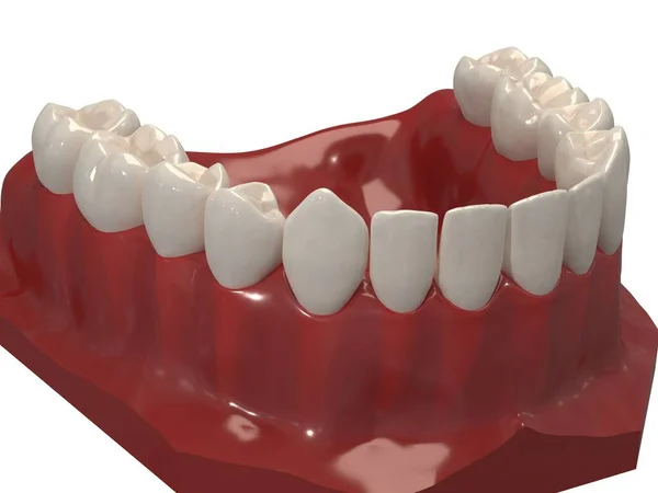 Ortodontik cihazlar, ortodontik tedavi sonrası muhafaza için kullanılır. 3d hazırlayıcı