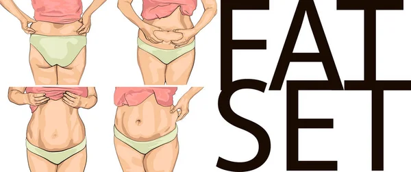 Készlet nők kövér has. — Stock Vector
