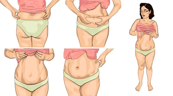 Definir mulheres com barriga gorda . —  Vetores de Stock