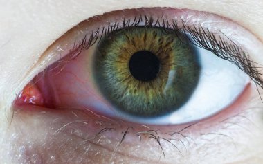 Odak kırmızı göz