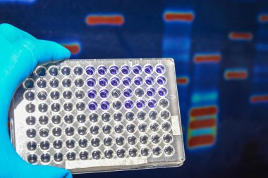 Laboratuvar DNA testi. Elektroforez görüntüsünün arka planında 96 kuyu plakası var..