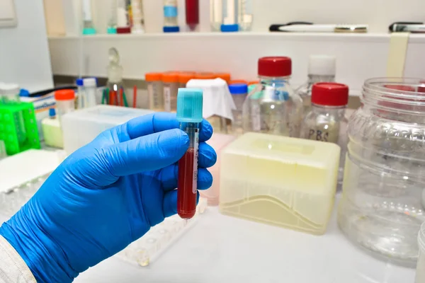 Estudio Laboratorio Sangre Mano Con Tubo Ensayo Fondo Los Instrumentos —  Fotos de Stock