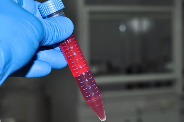 Анализ крови в лаборатории . — стоковое фото