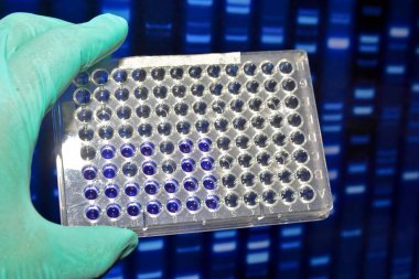 Dna testi laboratuvarda.