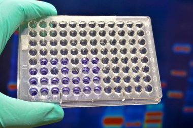 Dna testi laboratuvarda.