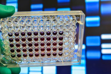 DNA testi. 