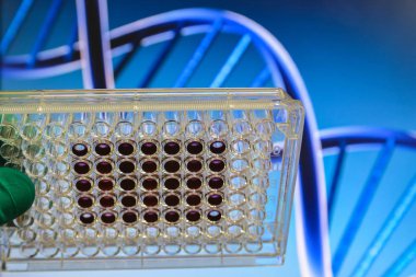 DNA testi. 