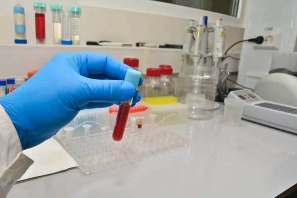 Examen en laboratoire d'un échantillon de sang . — Photo