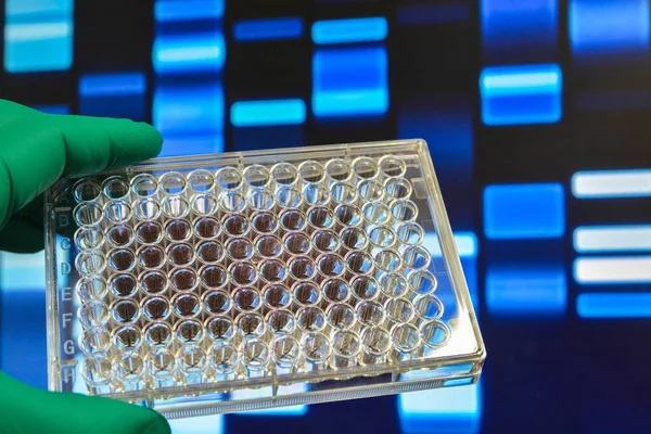 Dns Teszt Genomikai Kutatás Laboratóriumban — Stock Fotó