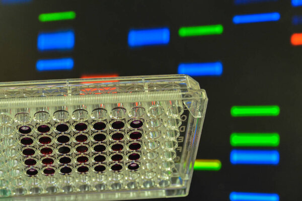 DNA testing. Genome research in the laboratory.