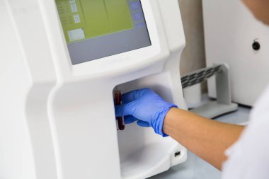 Kan Hematoloji Analizörü. Laboratuarda tıbbi işçinin yakın.