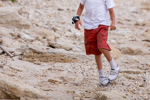 Boy Walking Clubfoot Defect — Stock Photo, Image