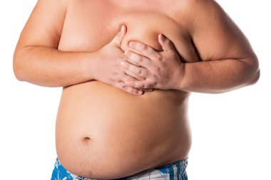 Büyük göbek ile şişman adam. Sağlık sorunları. Obezite, bir heartattack