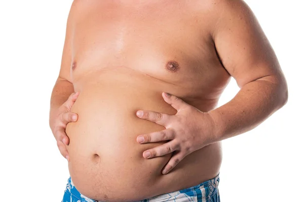 Hombre Gordo Con Barriga Grande Problemas Salud Obesidad Hígado Enfermo — Foto de Stock