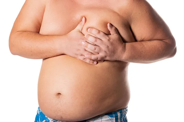 Tlustý Muž Velkým Břichem Zdravotní Problémy Obezita Heartattack — Stock fotografie