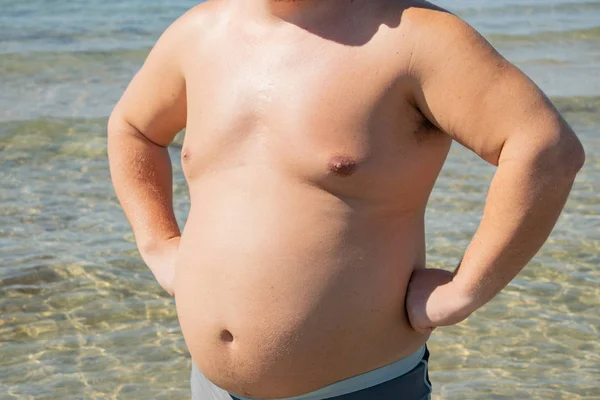 Fet Man Shorts Står Vid Stranden Havet Sol Och Semester — Stockfoto