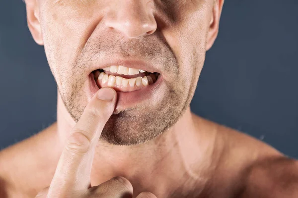 Sad depressed man in pain holding his gum. Portrait of a man on blue background.