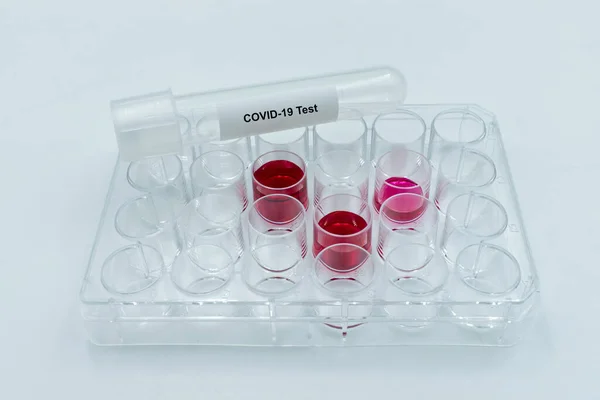 Provrör Med Covid Etikett Utrustning För Mikrobiologiska Laboratorier Coronavirus Covid — Stockfoto