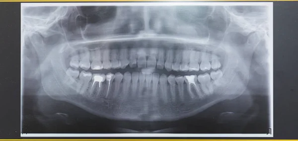 Dental clinic. Reception, examination of the patient. Teeth care. X-ray of human jaw.