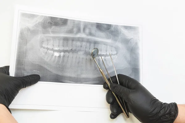 Dental clinic. Reception, examination of the patient. Teeth care. Dentist looks x-ray picture of a patients jaw.