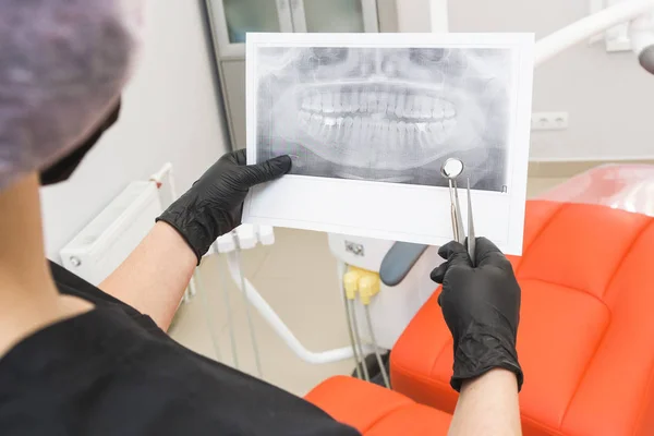 Dental clinic. Reception, examination of the patient. Teeth care. Dentist looks x-ray picture of a patients jaw