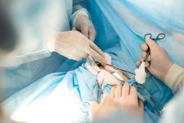 Ameliyat sırasında doktorların eldiven taktığı yakın çekimler.