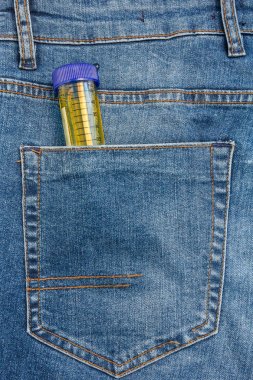 Mavi Jeans Cebinden İdrar Çıkma Testi Neziz Görüntü