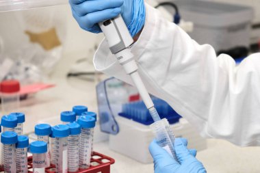 Kapalı kadın eli lastik mavi eldivenlerle otomatik pipetle Falcone test tüpünden örnek alır. Laboratuvarda klinik ya da kimyasal analiz.. 