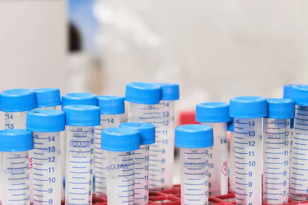 Muchas trompas de halcón con tapas azules en el bastidor. Preparación de muestras en laboratorio químico o clínico. — Foto de Stock