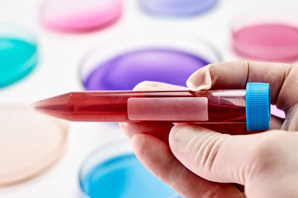 Campione di sangue in una provetta di plastica sullo sfondo della capsula di Petri con liquidi colorati o supporti. Microbiologia o ricerca chimica. — Foto Stock