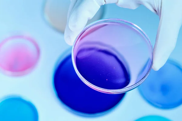 Acerque a un científico o biólogo con guantes de goma que sostienen una placa de Petri con medios coloridos para injertar colonias bacterianas o análisis bioquímicos. — Foto de Stock