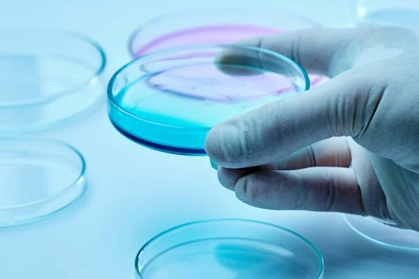 Avvicinare uno scienziato o un biologo in guanti di gomma con una capsula di Petri con supporti colorati per innestare colonie batteriche o analisi biochimiche. — Foto Stock