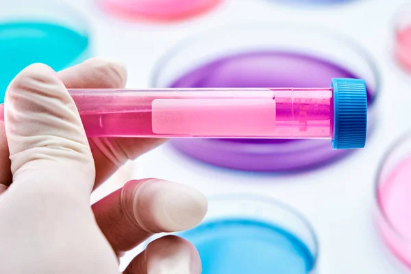 Provetta con liquido blu in mano dello scienziato sullo sfondo delle capsule di Petri per analisi microchimiche. Sviluppo di vaccini e prodotti farmaceutici. — Foto Stock