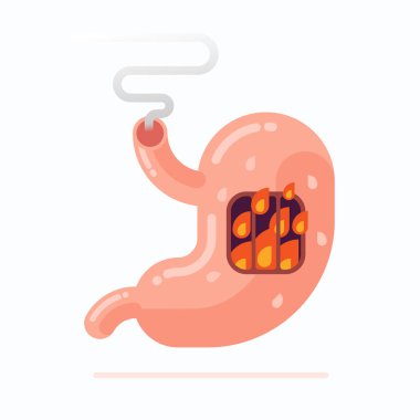 Flat vector Illustration of human stomach burning, heartburn disease concept clipart