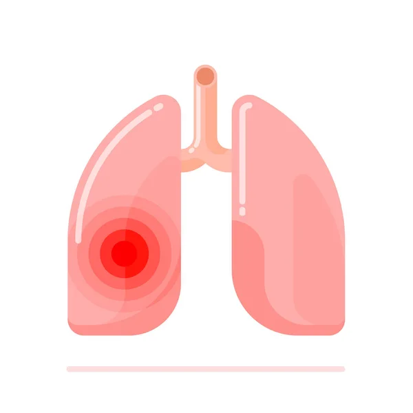 Desenho plano ilustração da doença dos pulmões humanos — Vetor de Stock