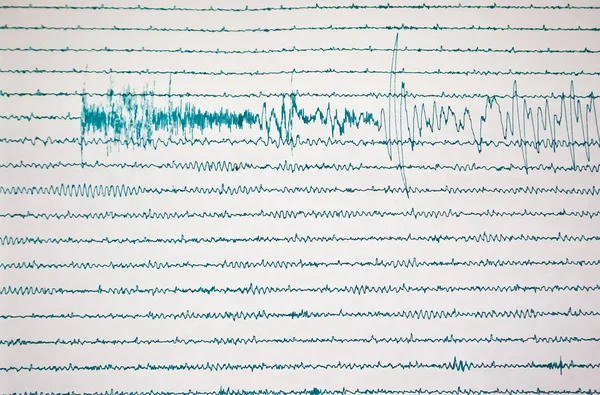 Depremsismograf Kaydı