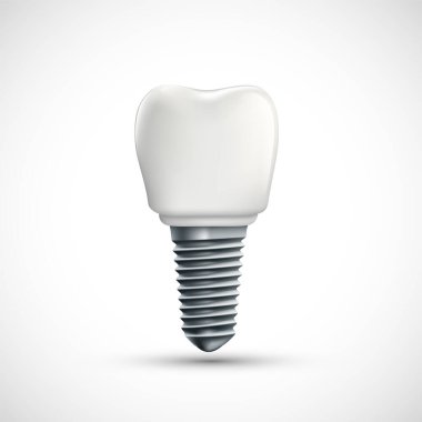 Diş implantı simgesi. Beyaz arka planda izole edilmiş. Vektör illüstrasyonu.