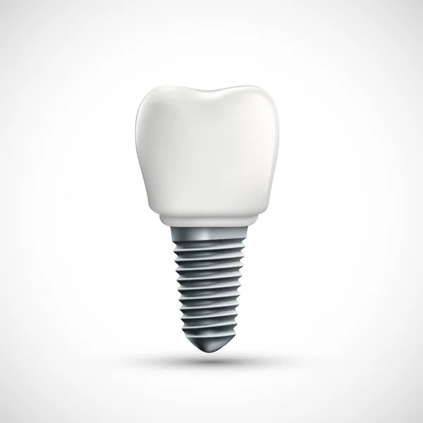 Ikona Zubního Implantátu Izolované Bílém Pozadí Vektorová Ilustrace — Stockový vektor