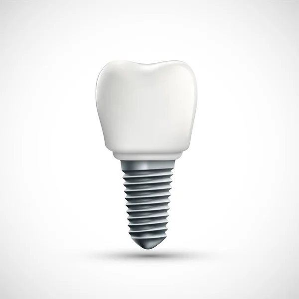 Dental Implant Icon Isolated White Background Vector Illustration Stock Illustration