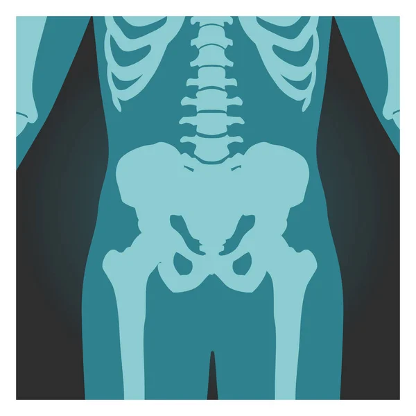 Röntgenbild av bäckenet och ryggrads pelaren, människokroppen ben, radiografi, vektor illustration. — Stock vektor