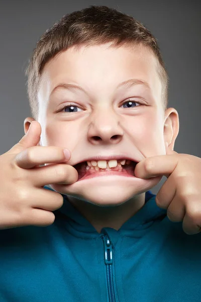 面白い子供 口を開けて少年 醜い顔をしかめる子 — ストック写真